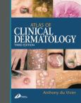 Atlas Of Clinical Dermatology