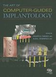 Art Of Computer-Guided Implantology