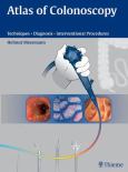 Atlas Of Colonoscopy: Techniques, Diagnosis, Interventional Procedures
